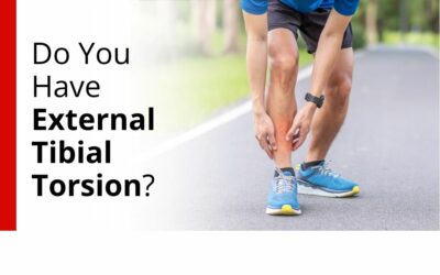 The Hidden Link Between Leg Alignment and Lasting Pain: Understanding External Tibial Torsion